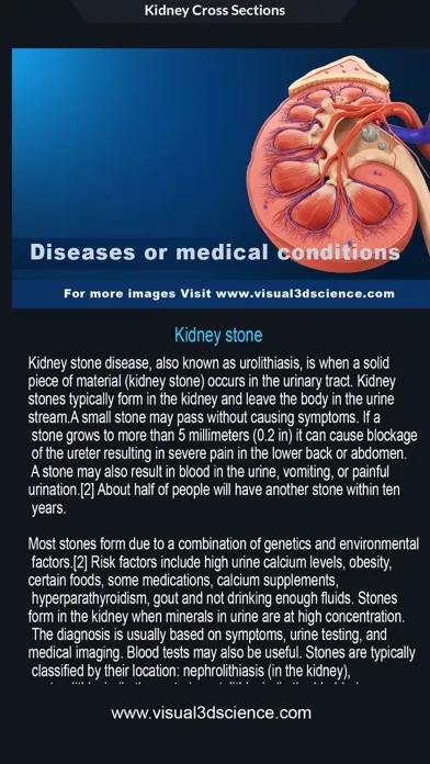 Tangkapan skrin My Kidney Anatomy